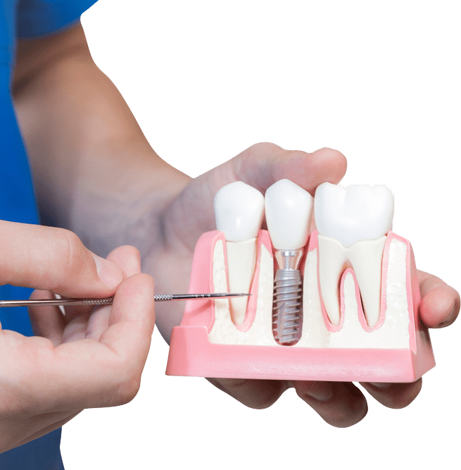 Dental Surgery Experts In Surrey