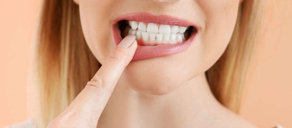 Close-up of a woman pulling down her lip to point at her gums, which show some redness near the gumline.