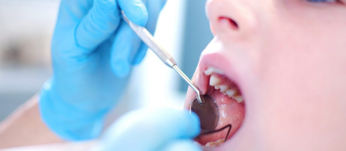 dental-implants-for-teens-V2