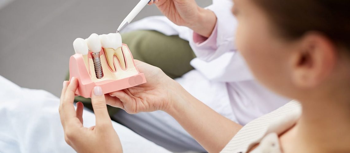 how-long-do-dental-implants-last